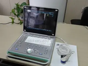 Ultrasound Scan Machine