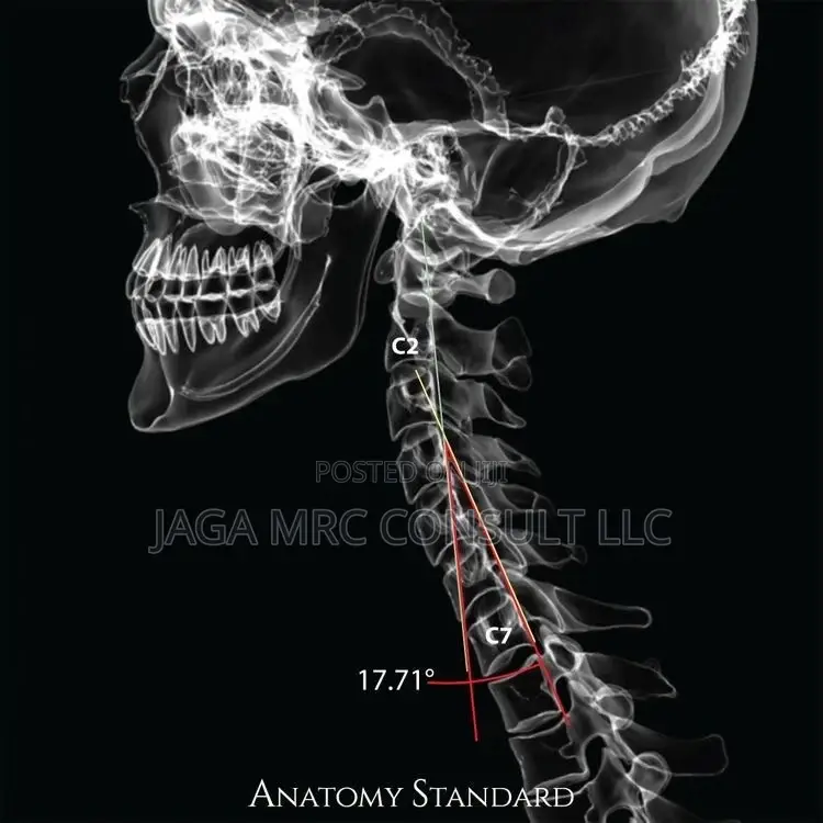 Physiotherapy