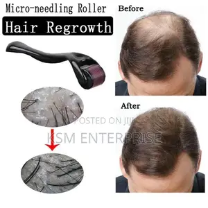 Derma Roller
