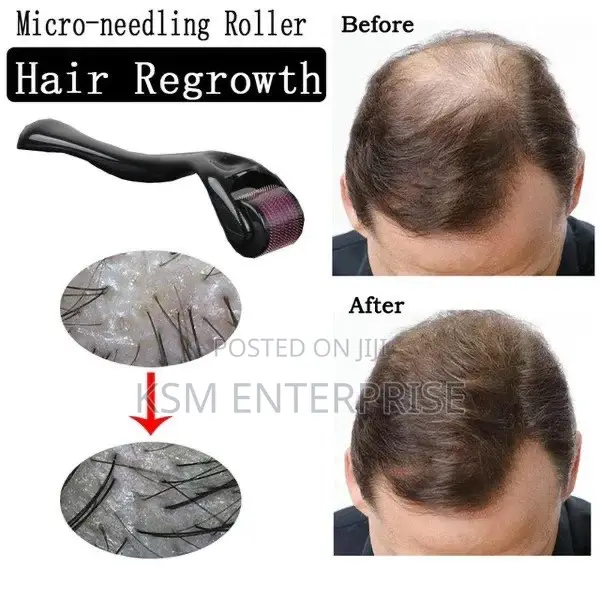 Derma Roller
