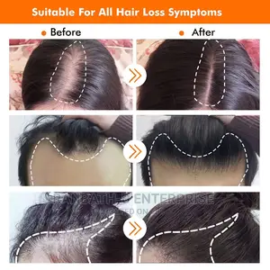 Derma Hair Roller System (0.5mm)