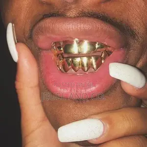Original 14k Gold Grillz / Slugs