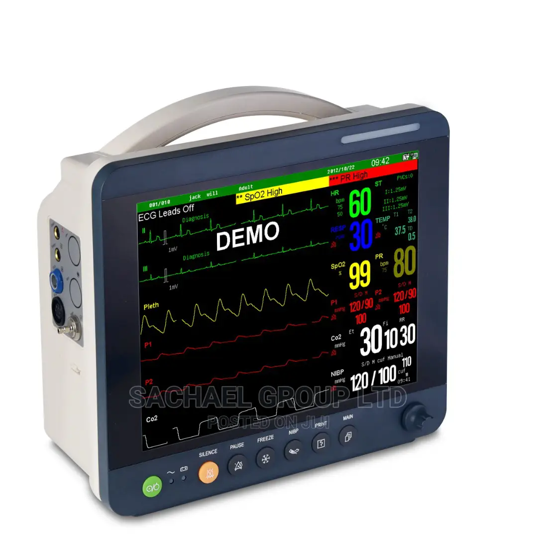 Icu Patient Monitor
