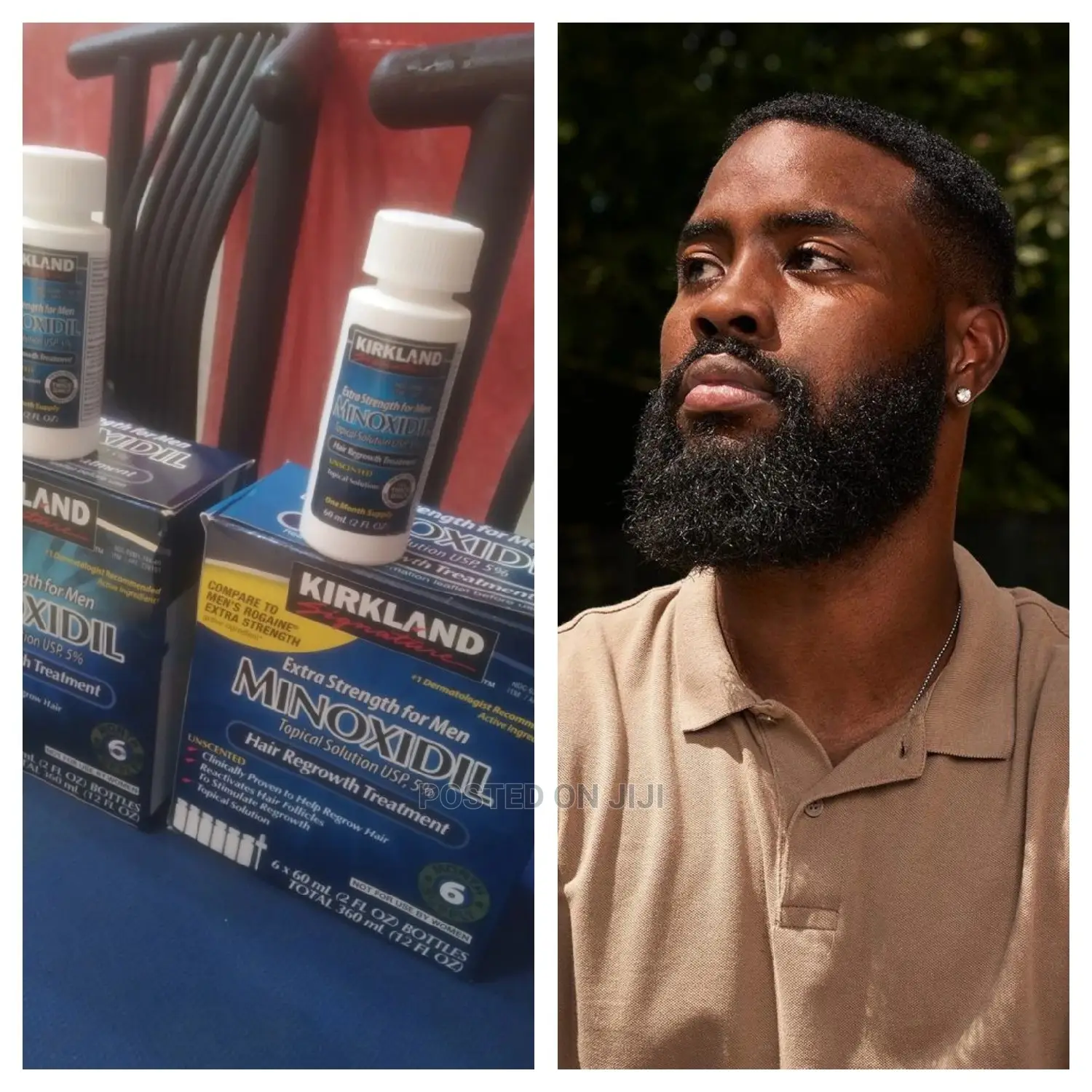 Beard Growth Oil/Booster (Kirkland Minoxidil)