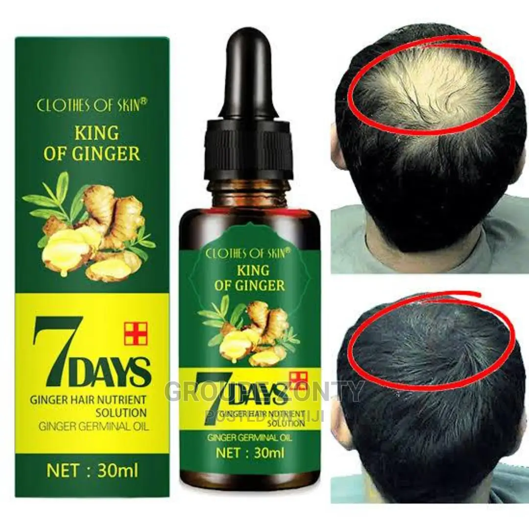 7 Days Magic Hair Growth Oil