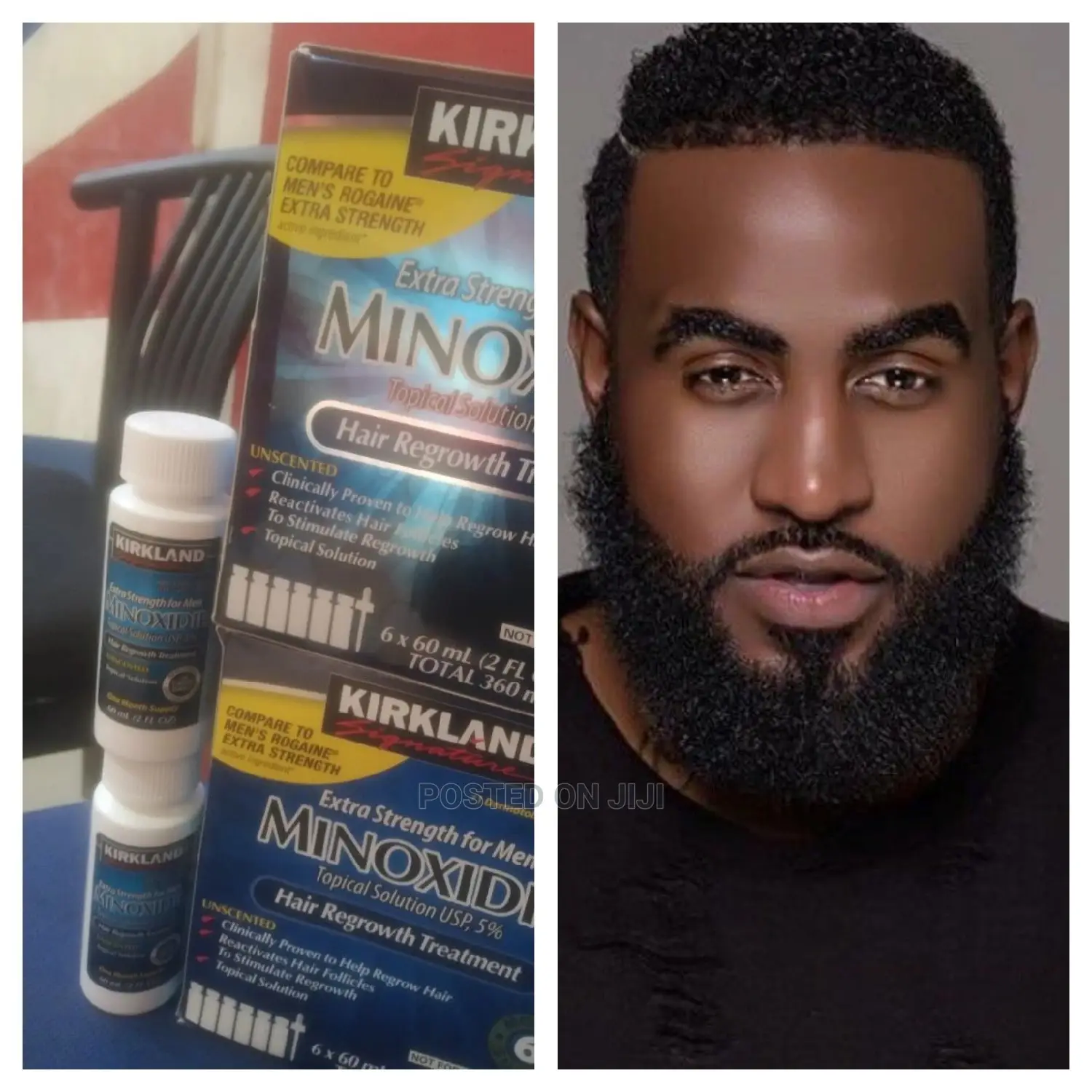 Originalkirkland Minoxidil