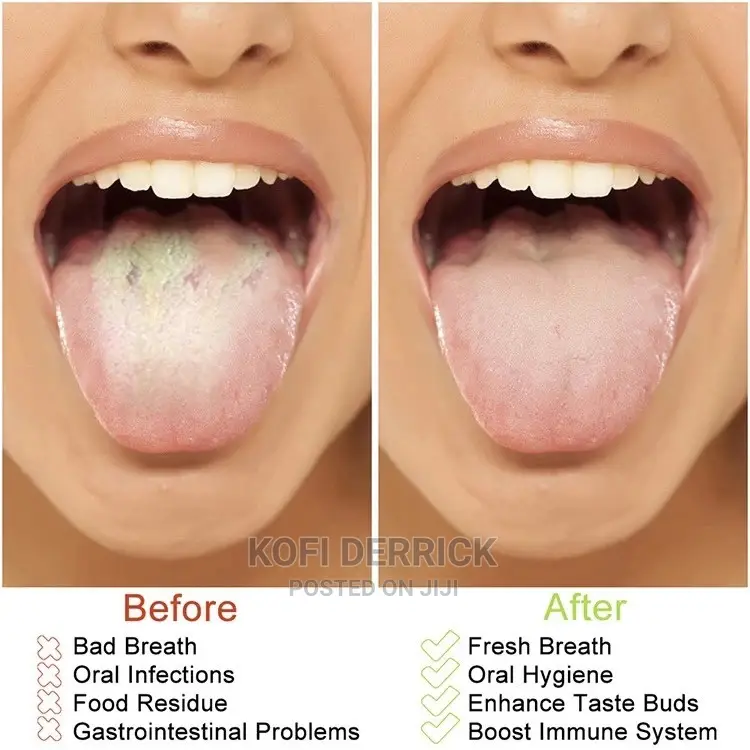 3pcs Tongue Scraper in Lapaz Tools & Accessories, Kofi Derrick Jiji