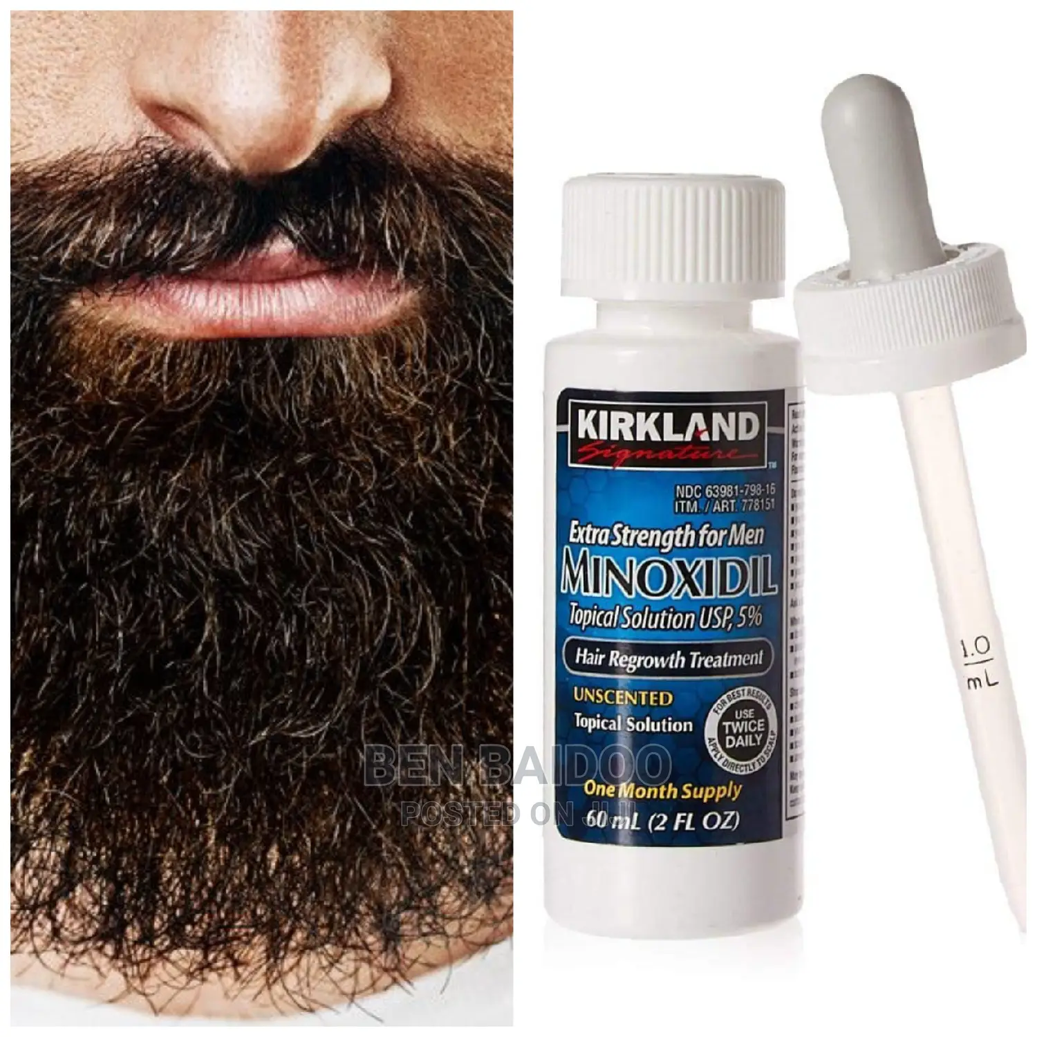 Kirkland Minoxidil for Beard