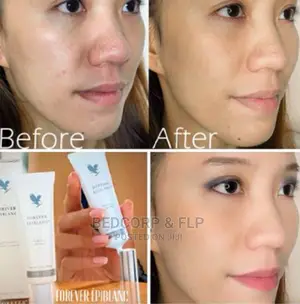 Forever Epiblanc Dark Spots Clearer
