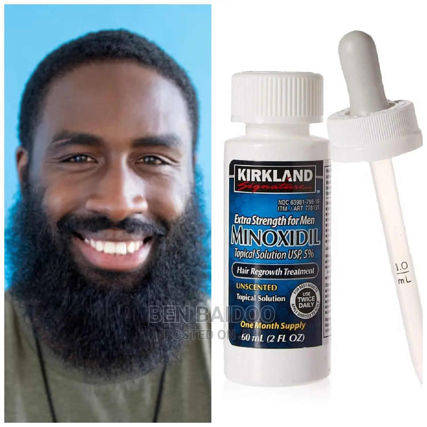 Kirkland 5% Minoxidil (Hair Beard Growth)