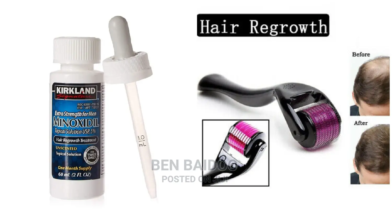 Kirkland Minoxidil Oil And Derma Roller 0.5mm