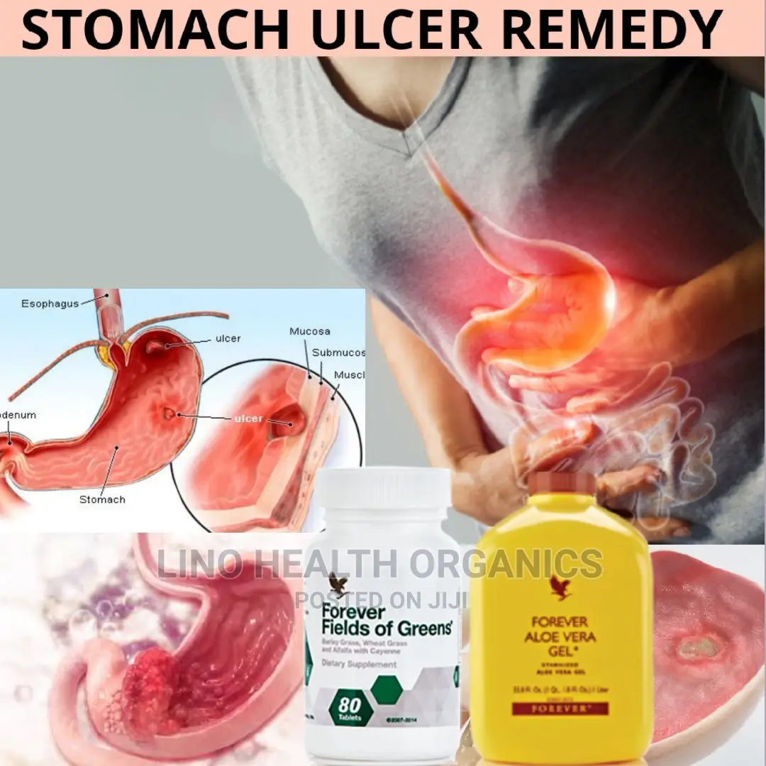 Stomach Ulcer Remedy