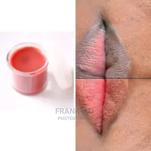 Smart Pink Lips Balm