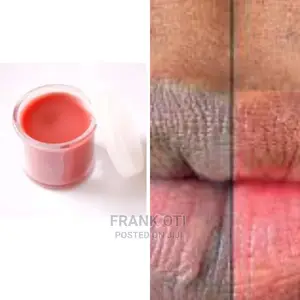 Dakar Pink Lips Balm