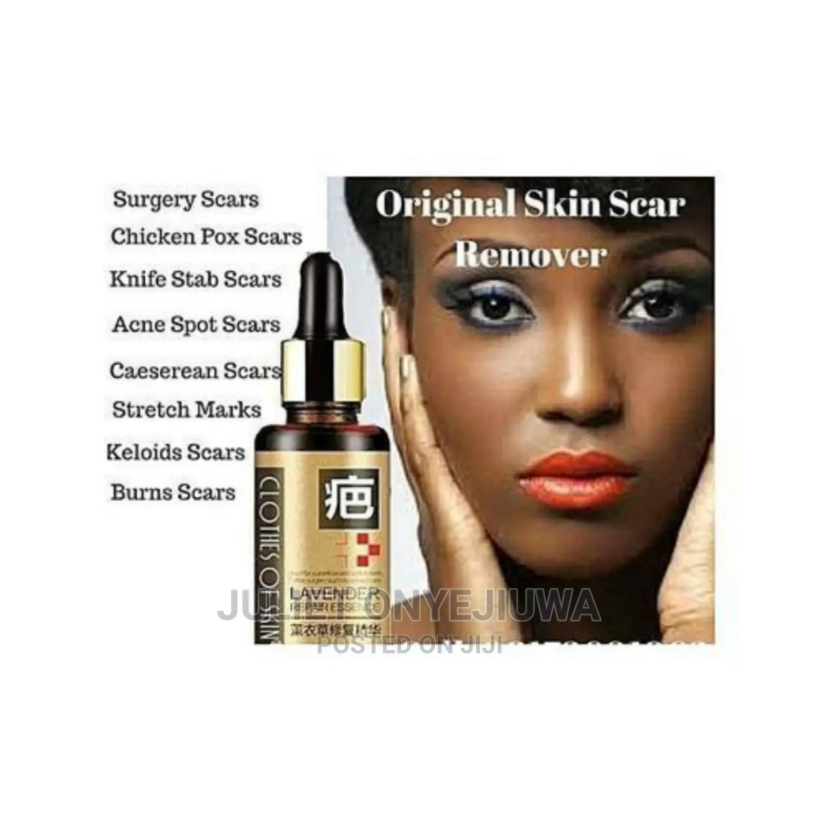 Lavender Repair Essence Serum for Stretch Marks, Scars and B