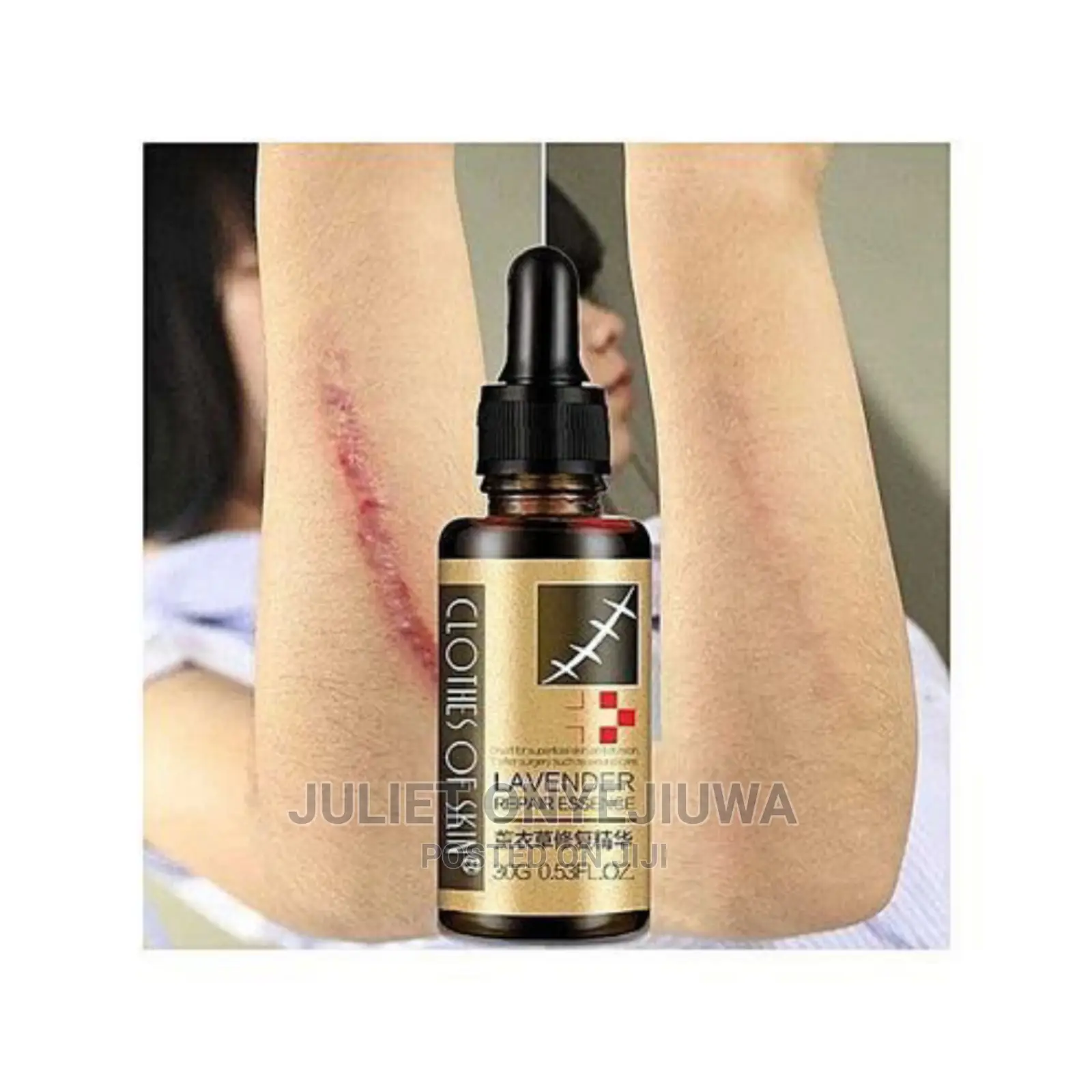 Lavender Repair Essence Serum for Stretch Marks, Scars and B