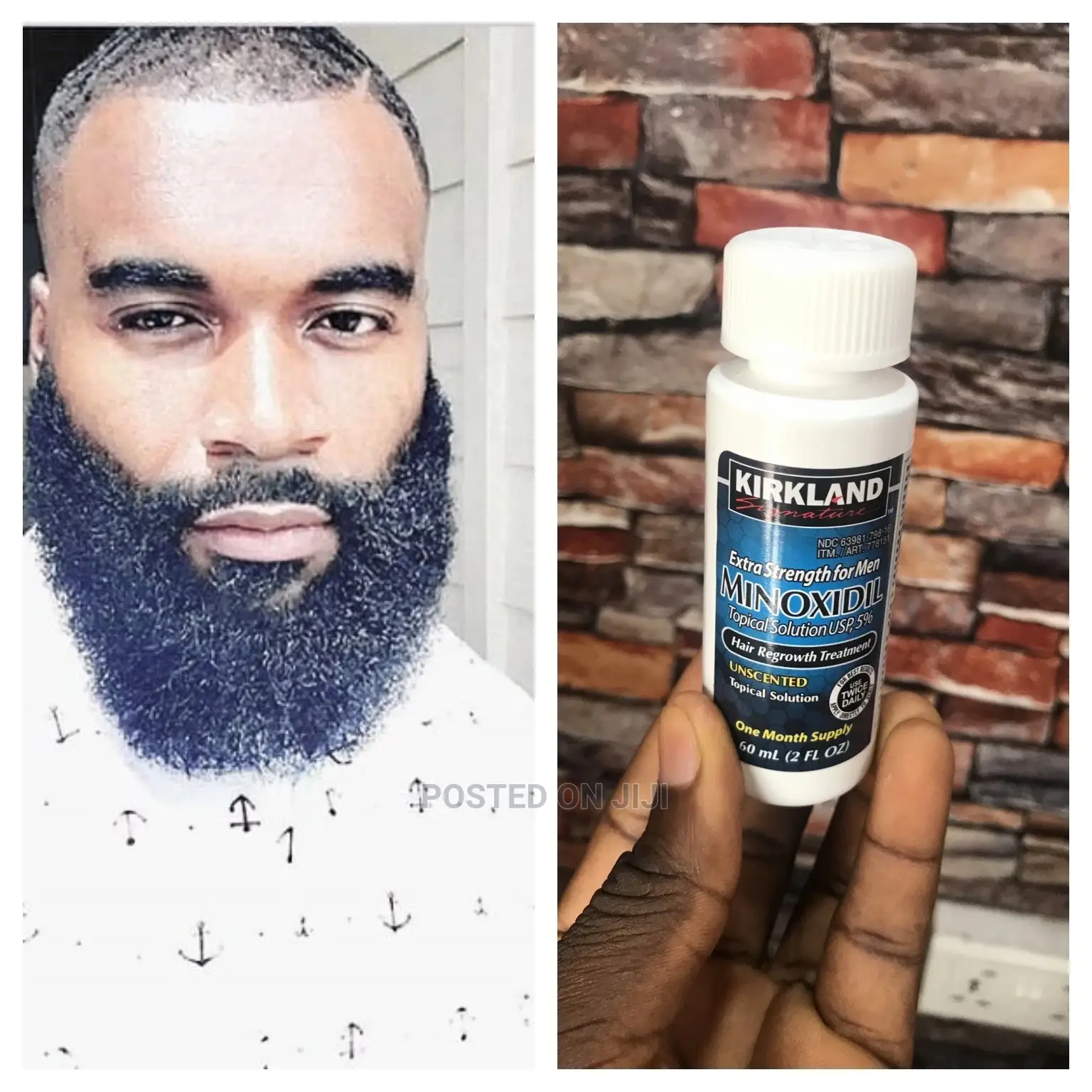 Beard/Hair Growth for Men Kirkland Minoxidil