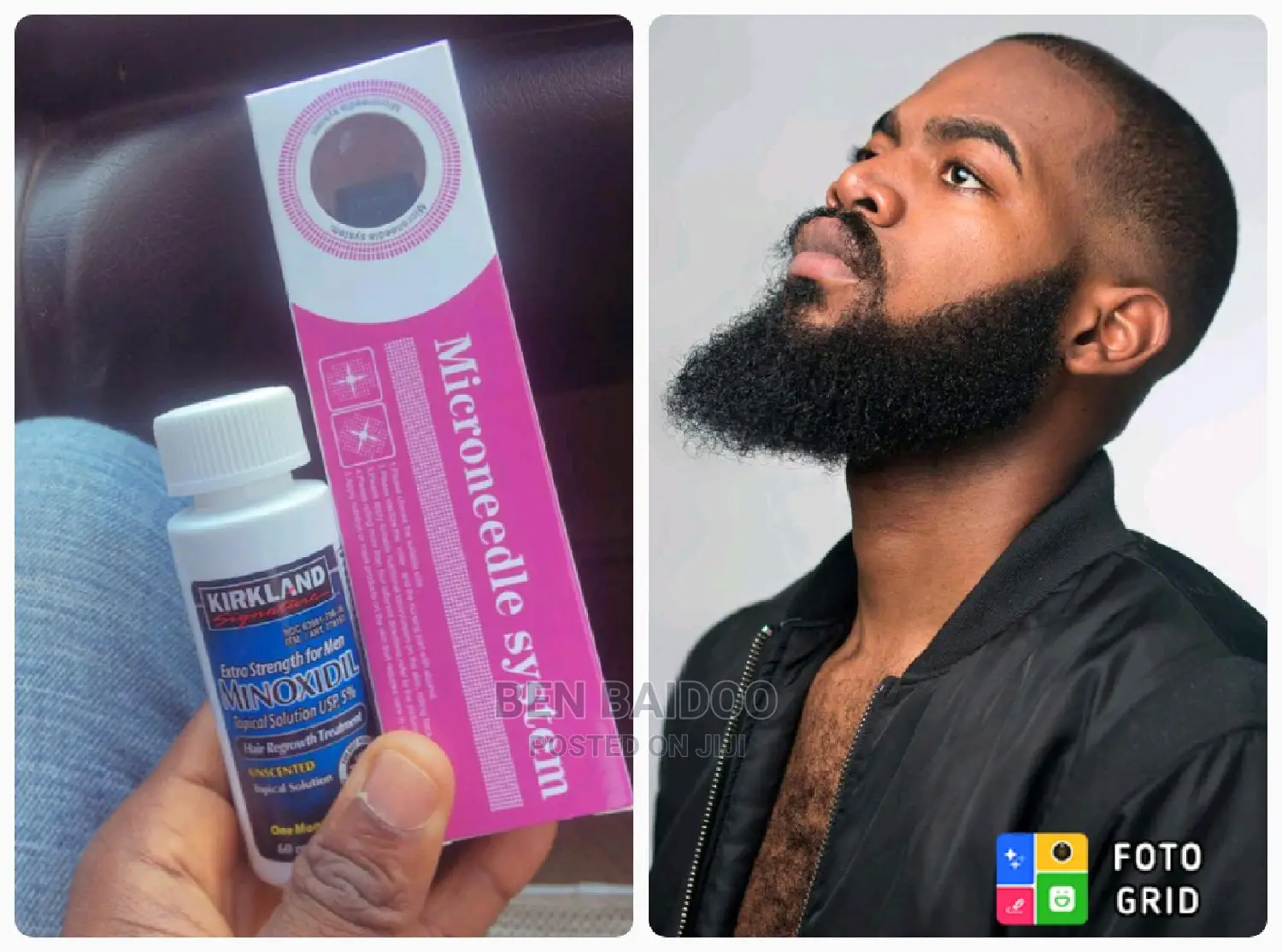 Hair Regrowth Combo (Kirkland Minoxidil and Derma Roller 0.5