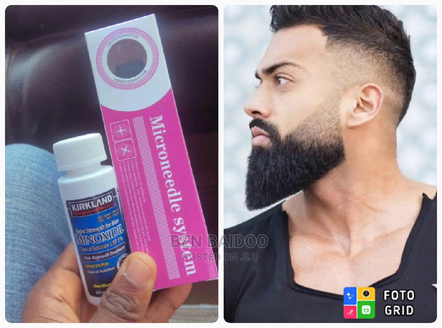Original Derma Roller (0.5mm) Kirkland Beard Growth Oil