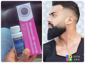 Original Derma Roller (0.5mm) Kirkland Beard Growth Oil