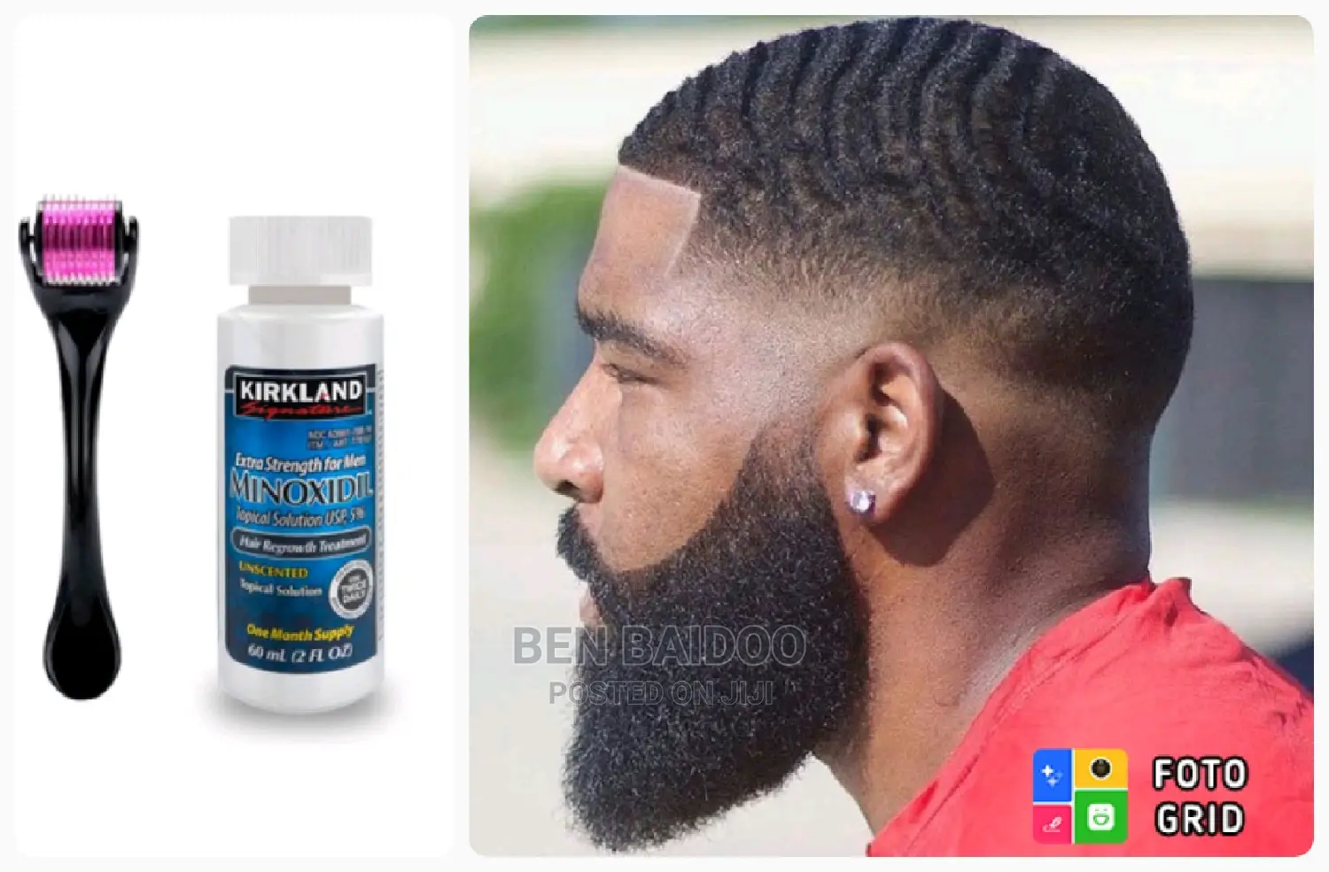 Kirkland+Derma Roller Pack