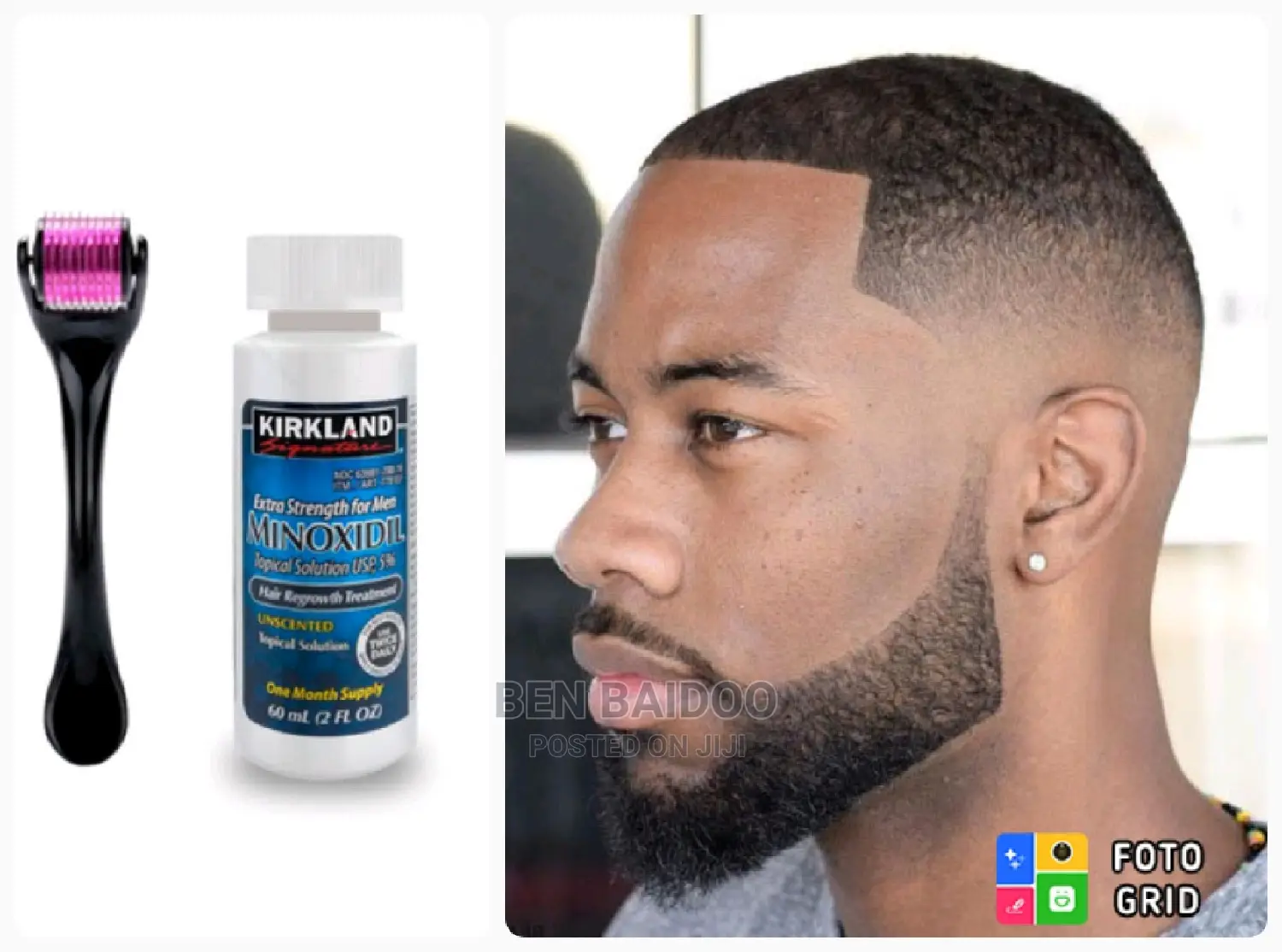 Kirkland Minoxidil Oil+Derma Roller 0.5mm