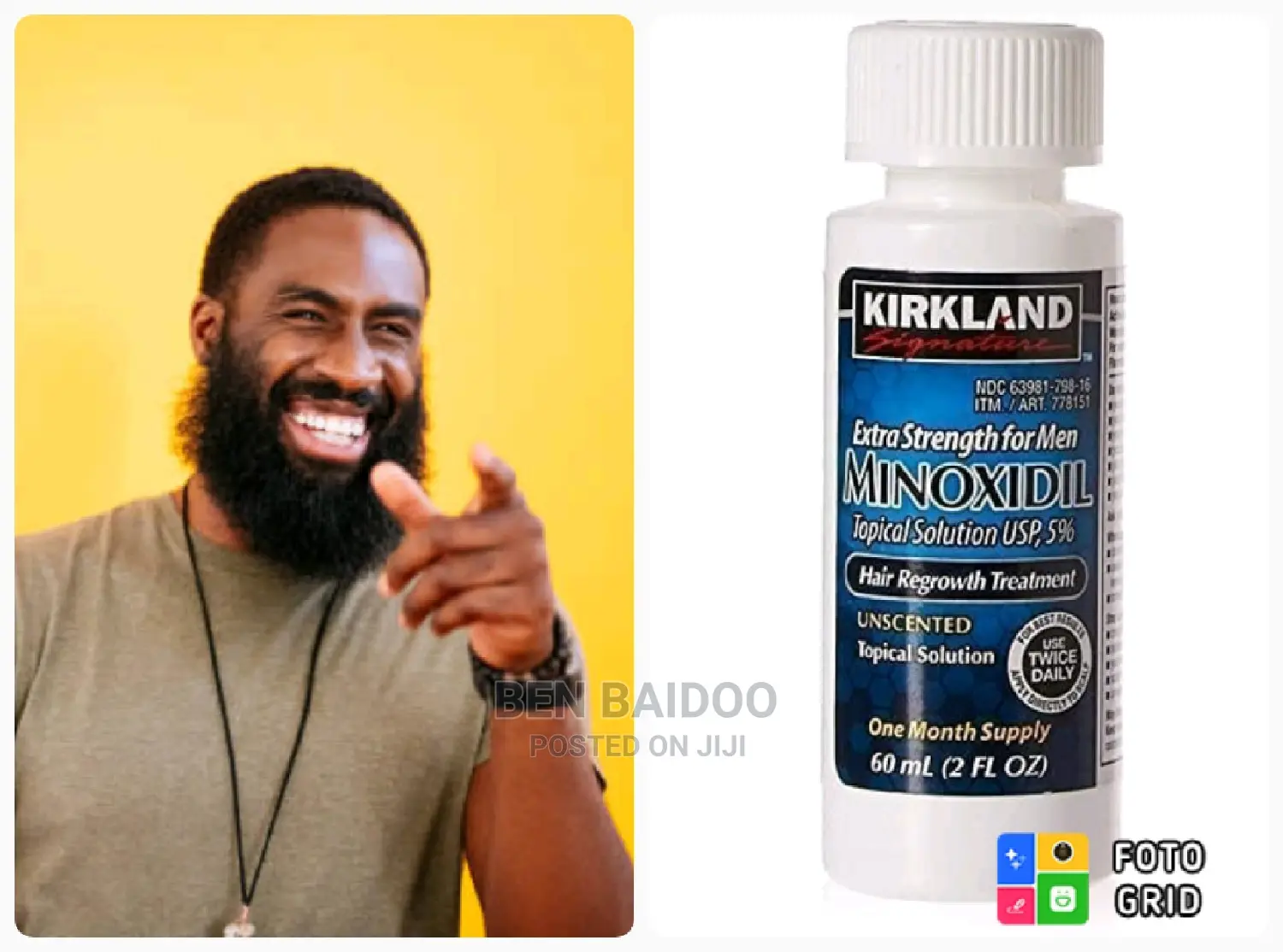 Kirkland Oil for Quick Beard Hair Growth