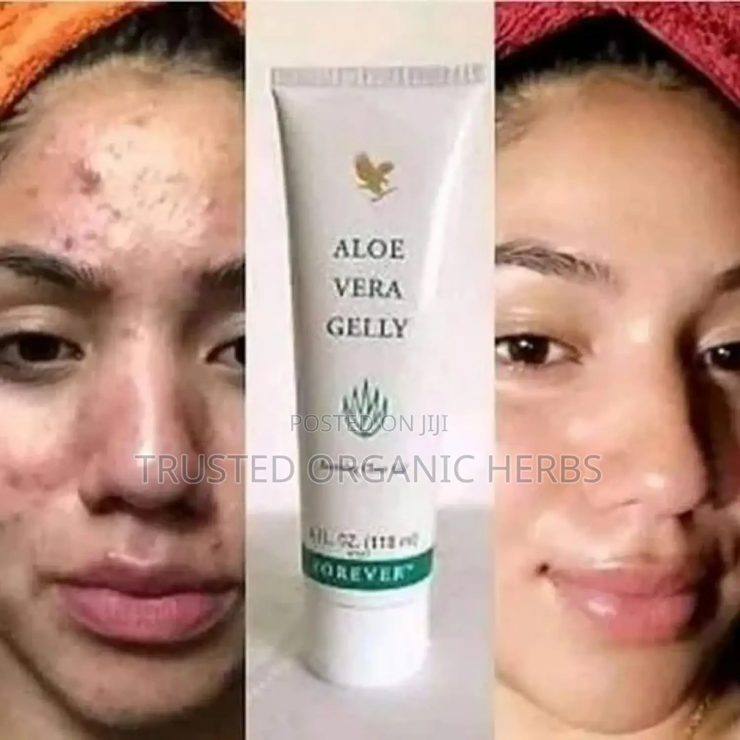 Forever Aloe Gelly - Soothes Clear Gel