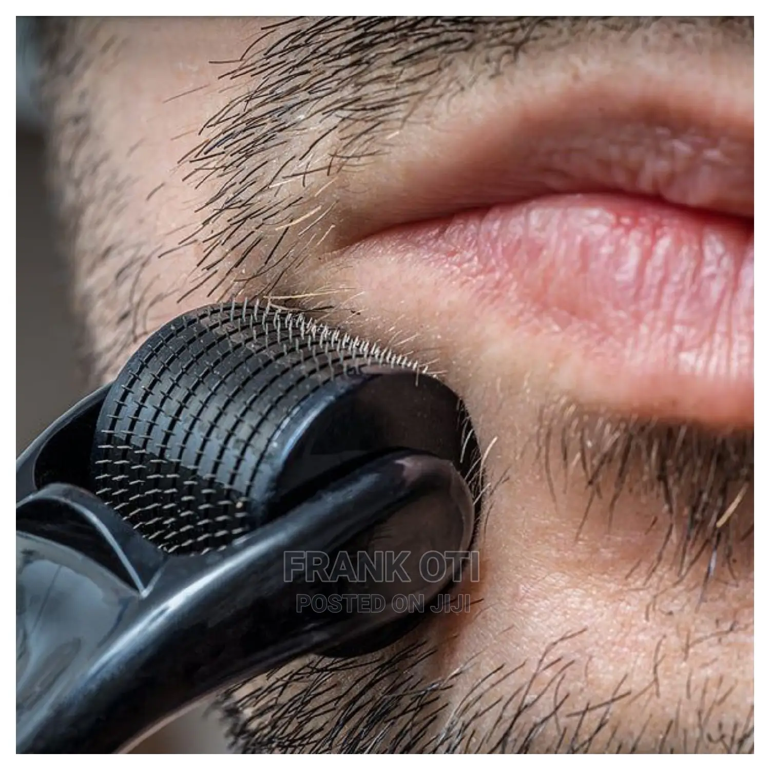 Derma Roller For Beard Growth