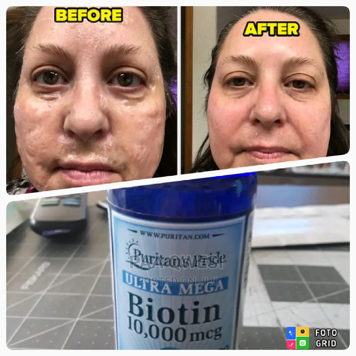 Utra Mega Biotin