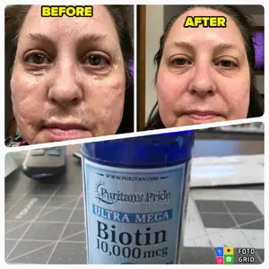 Utra Mega Biotin