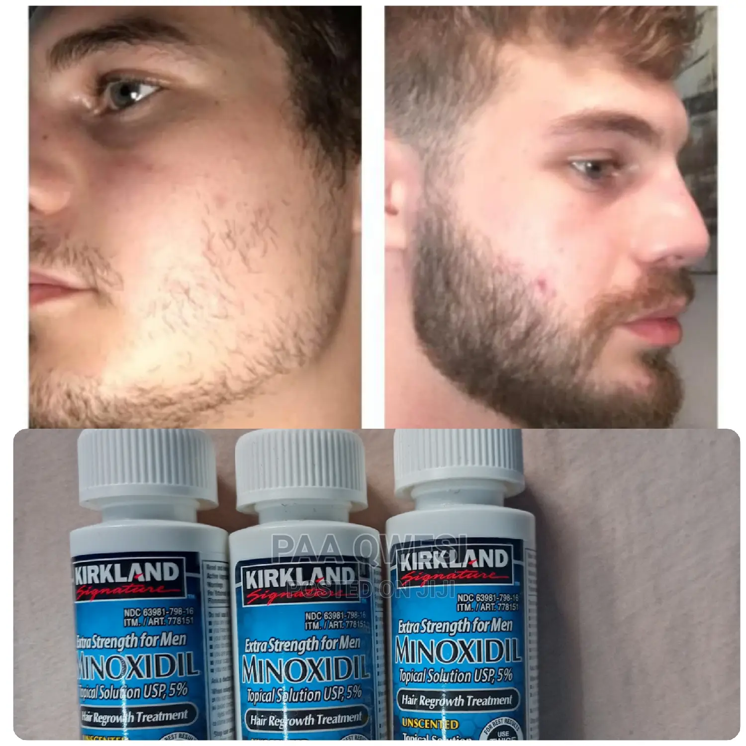 Kirkland Beard and Hairline Loss Oil.