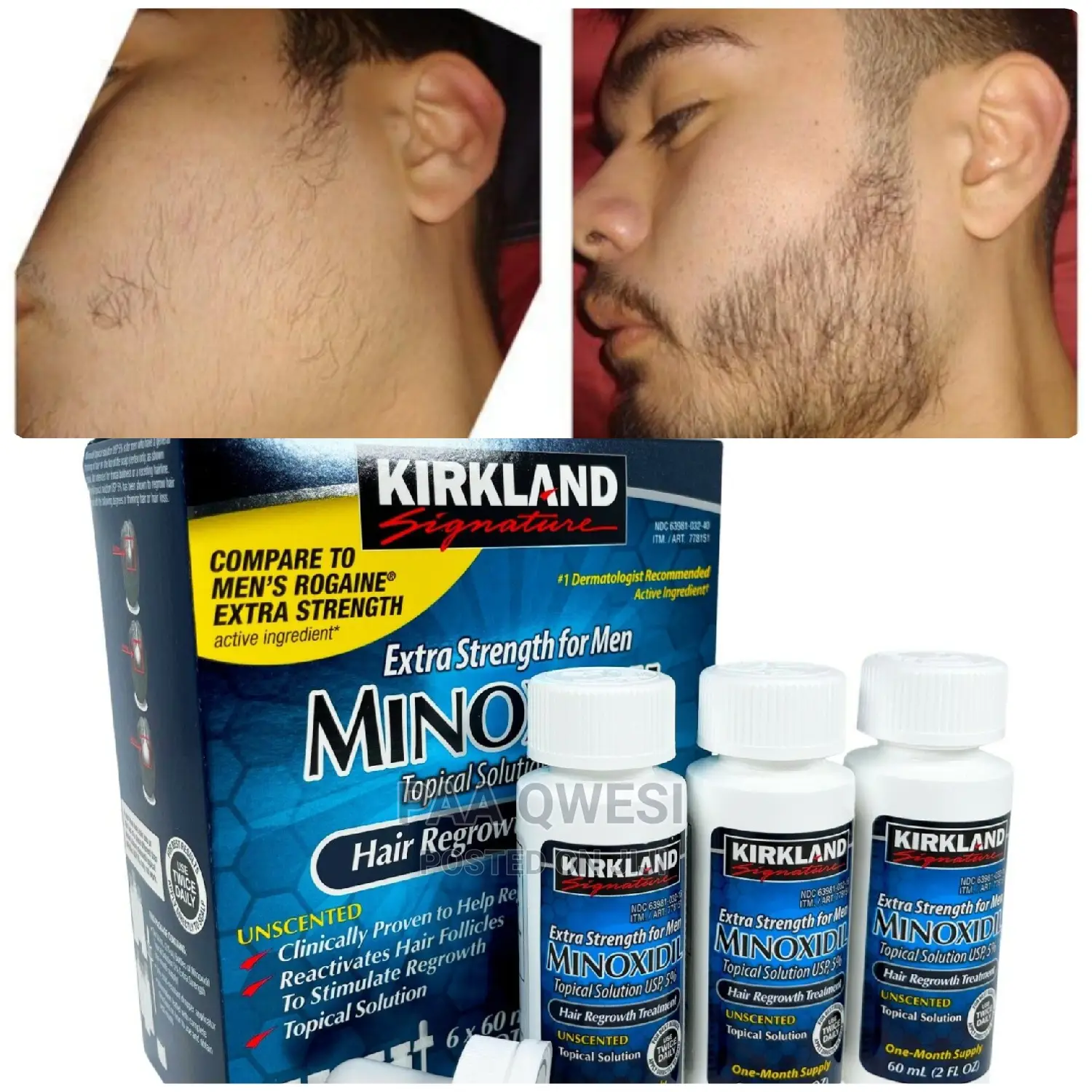 Kirkland for Beard Growth