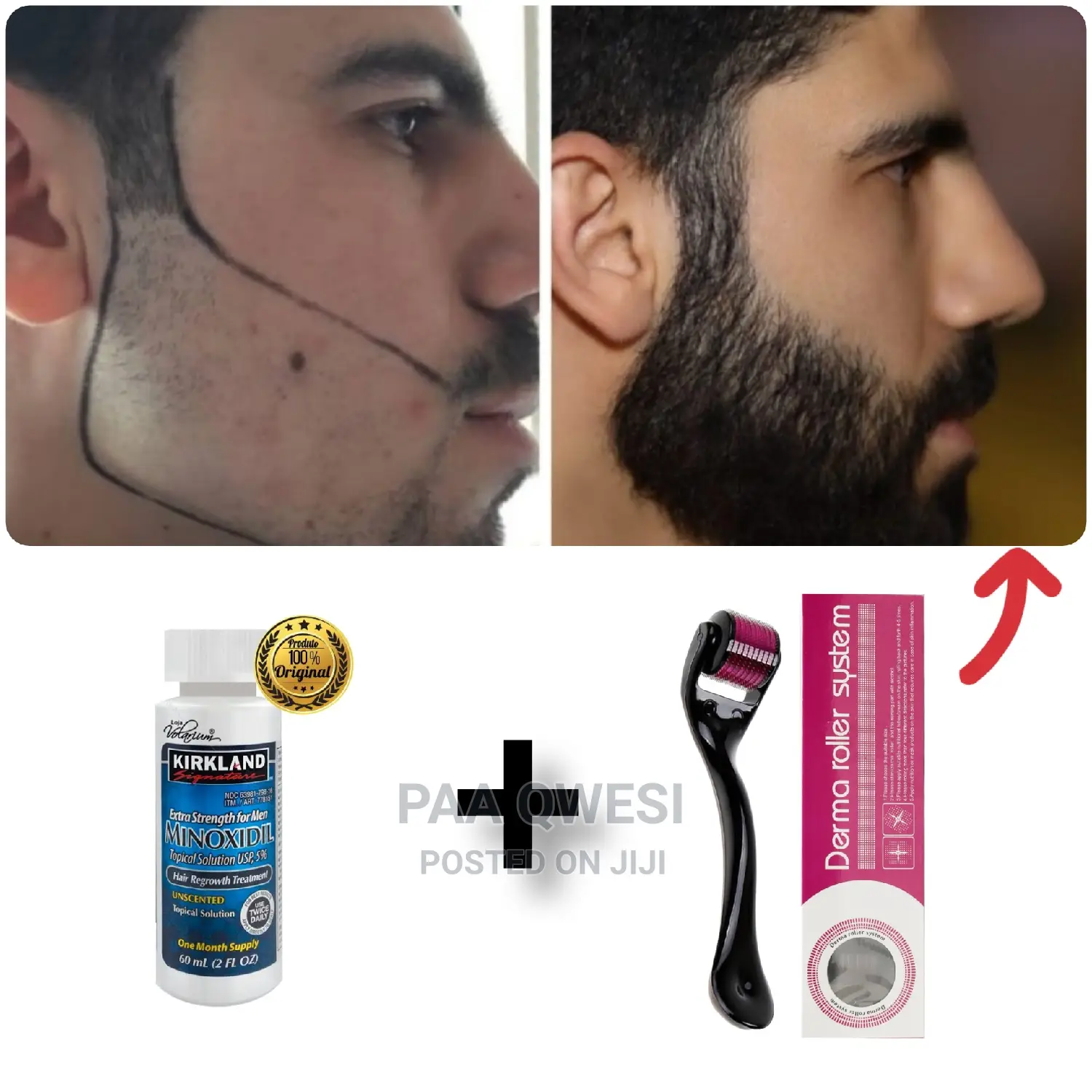 Kirkland Beard Oil /Derma Roller Instrument