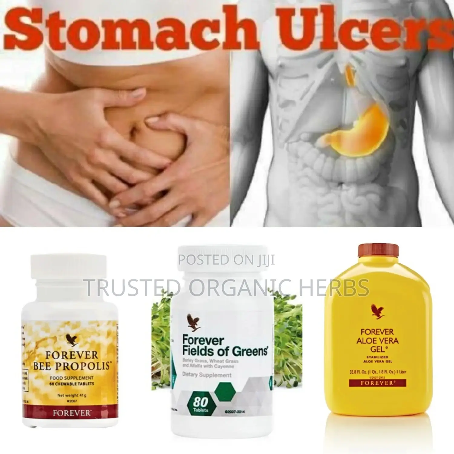 Natural Cure and Healing of Stomach Ulcer Permanently