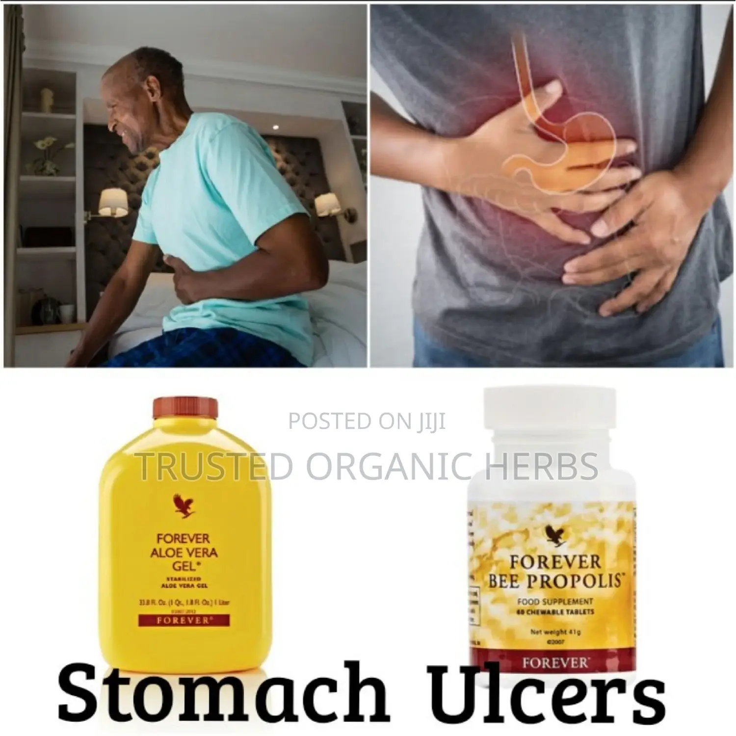 Gastric Ulcer Solution | Healing Sore Care Pack