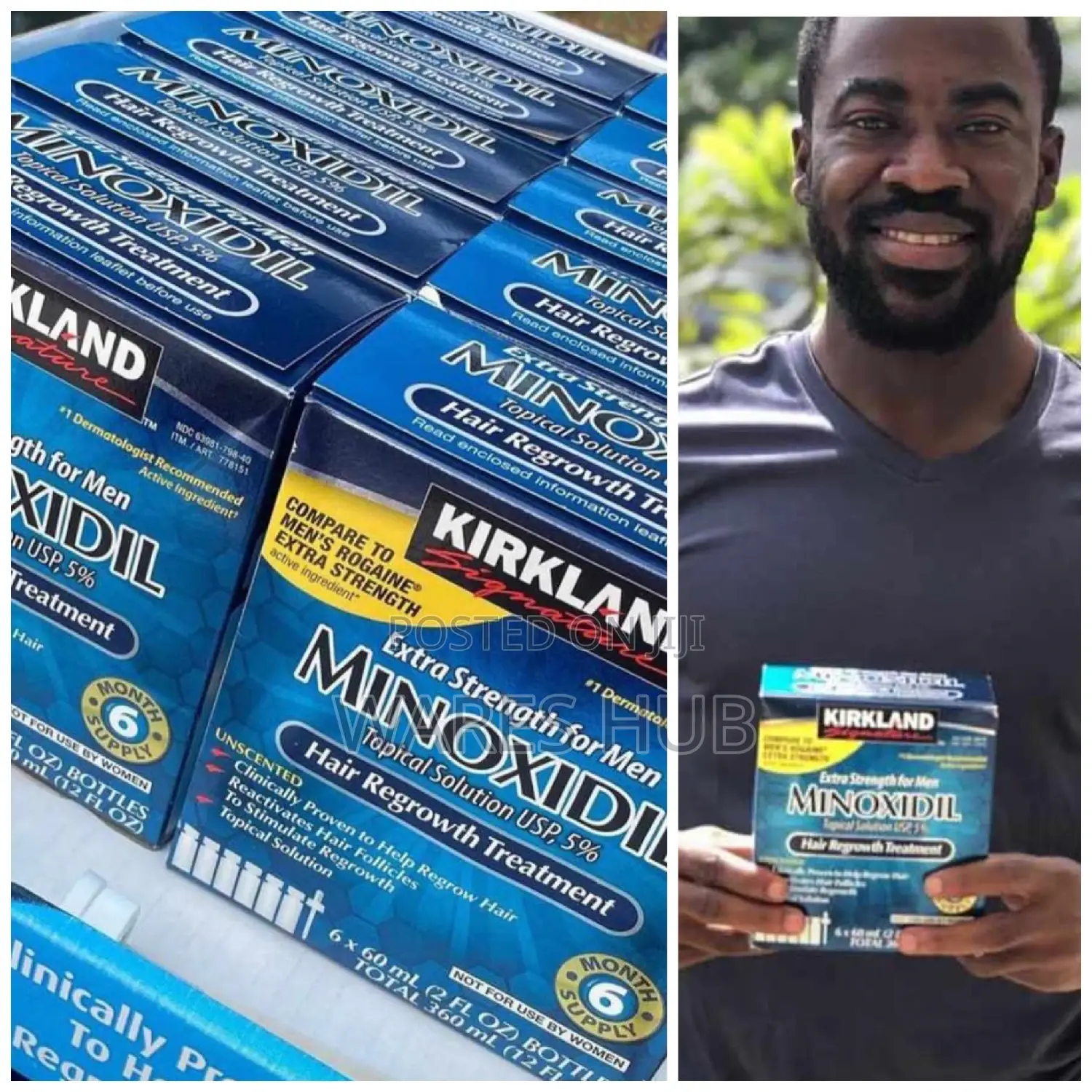 Kirkland Box Minoxdil Signature Topical Solution