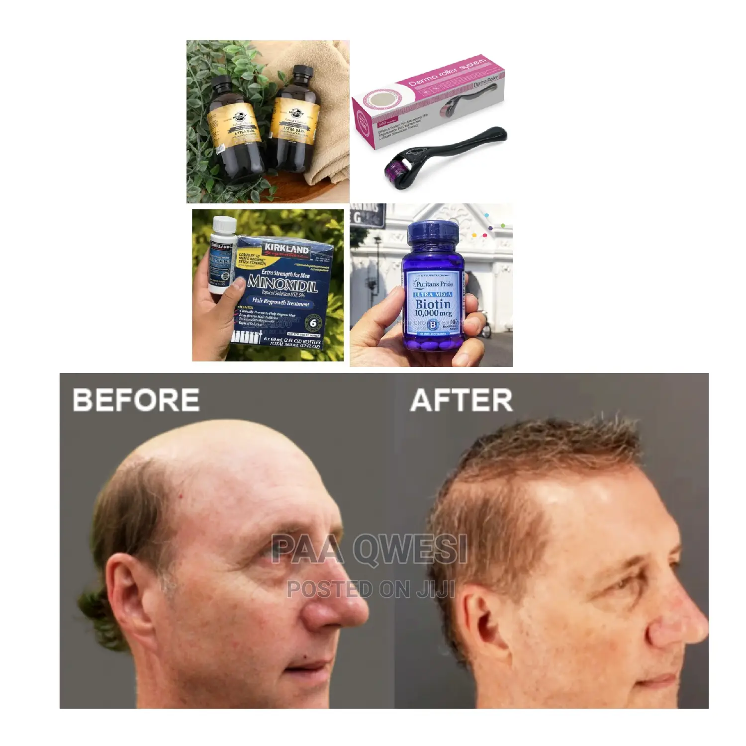 Jaimaca Castor Oil,Biotin,Derma Roller Kirkland{Utra}