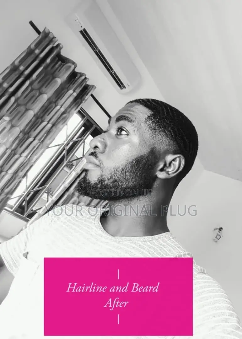 Kirkland Minoxidil + Derma Roller (Best Combo)
