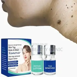 Medical Grade Skin Tag, Genital Wart and Mole Removal 2 in 1