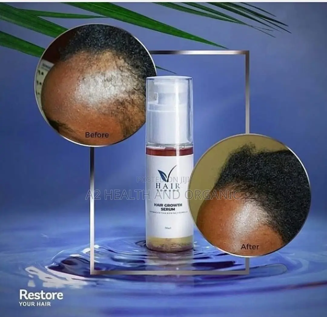 Hairnownow Hair Growth Serum
