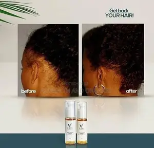 Hairnownow Hair Growth Serum