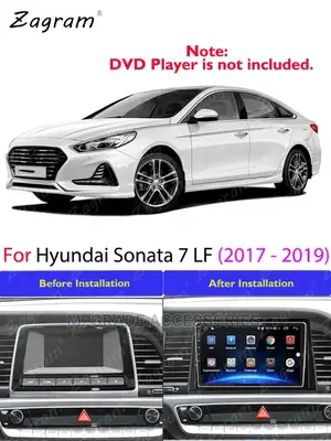 2017 - 19 Sonata Android Radio (Carplay / Android Auto)