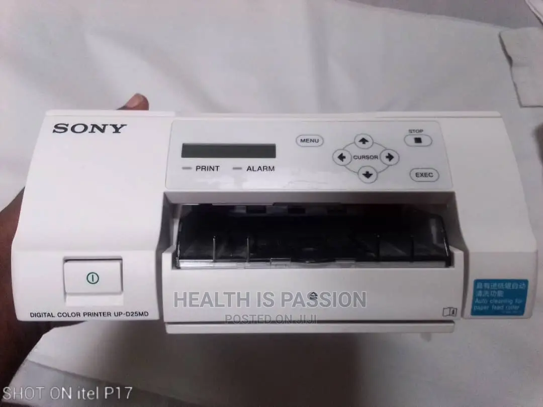 Brand New Sony Color Doppler Scan Printer Available