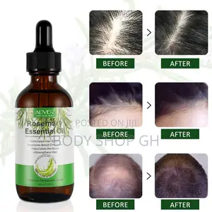 Rosemary Oil for Hair Growth - Stimulates Hair Growth