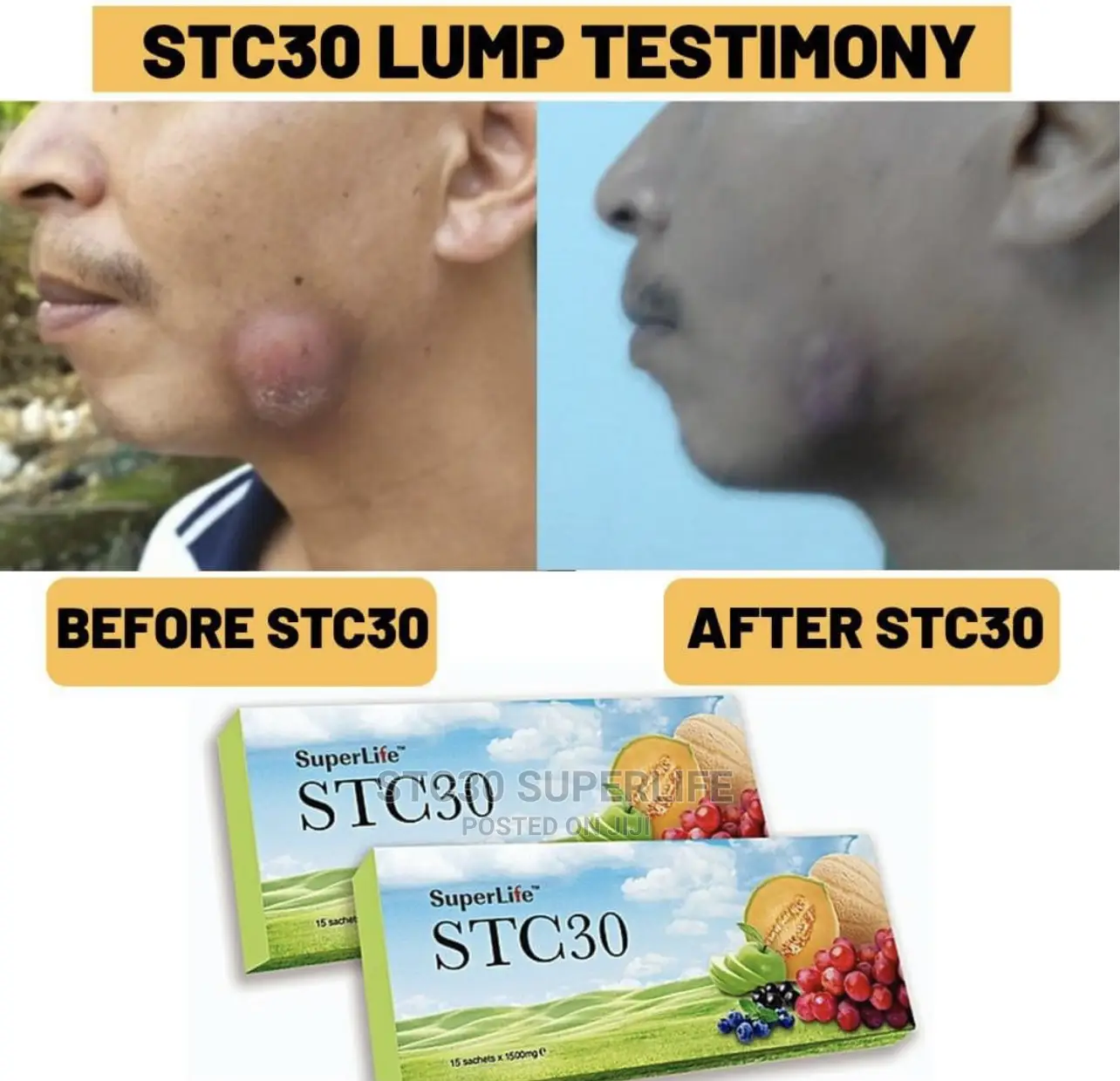 STC30 Medicinal Supplements
