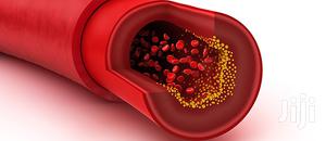 Natural Solution For High Blood Pressure