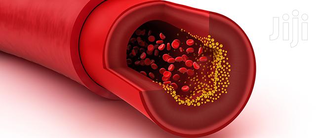 Natural Solution For High Blood Pressure