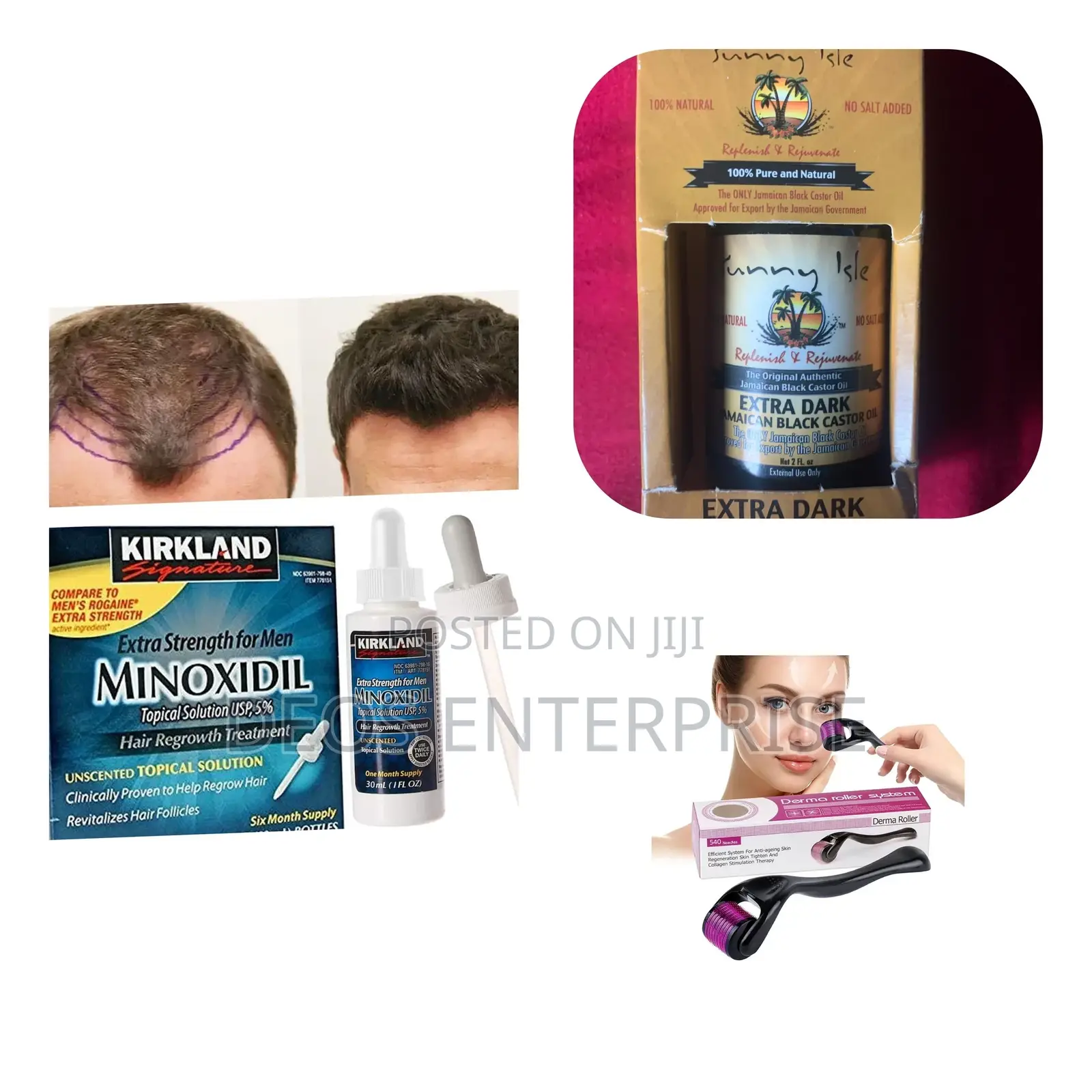 Beard and Hair Loss Product