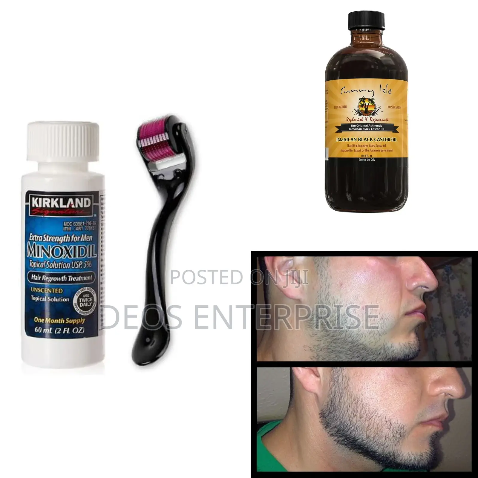 Super Beard Growth Combo